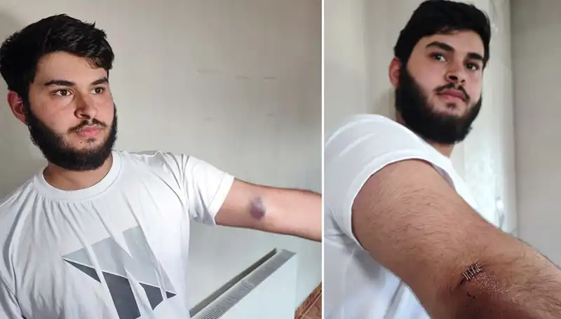 Bahçeye Kaçan Top, Mahallede Gerginliğe Neden Oldu: "Conolar Kamyonetle Geldi"