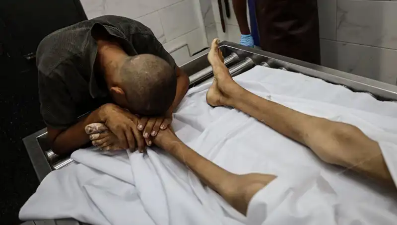 Gazze'de Açlık Kurbanı: Bir Çocuğun Trajik Hayatı Son Buldu